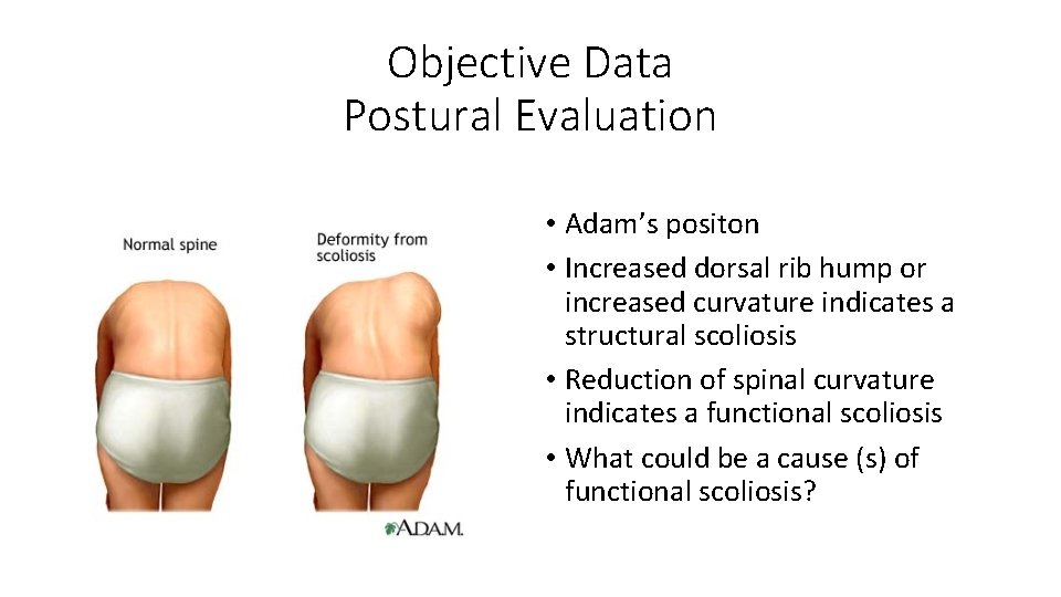 Objective Data Postural Evaluation • Adam’s positon • Increased dorsal rib hump or increased