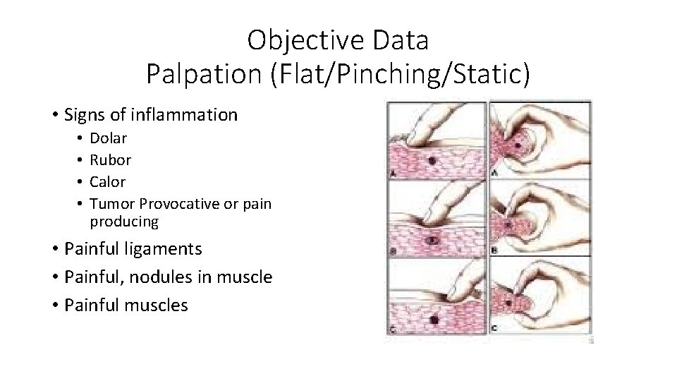 Objective Data Palpation (Flat/Pinching/Static) • Signs of inflammation • • Dolar Rubor Calor Tumor