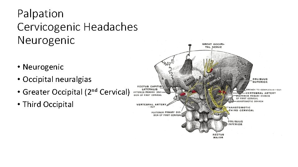 Palpation Cervicogenic Headaches Neurogenic • Occipital neuralgias • Greater Occipital (2 nd Cervical) •