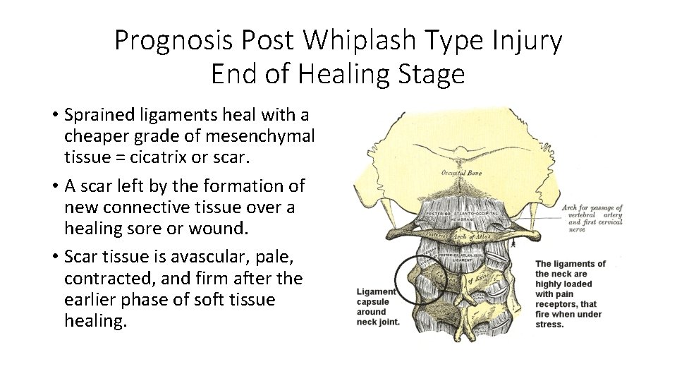 Prognosis Post Whiplash Type Injury End of Healing Stage • Sprained ligaments heal with