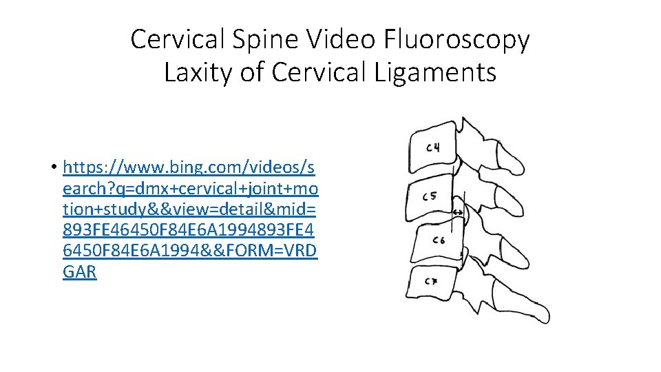 Cervical Spine Video Fluoroscopy Laxity of Cervical Ligaments • https: //www. bing. com/videos/s earch?