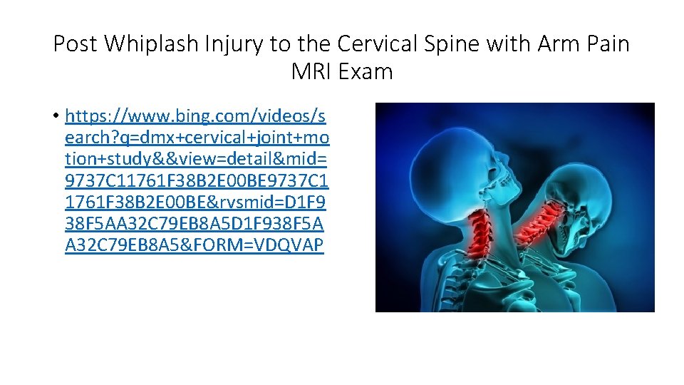 Post Whiplash Injury to the Cervical Spine with Arm Pain MRI Exam • https: