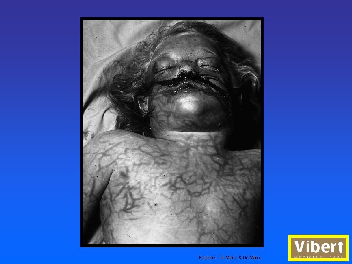 Fuente: Di Maio & Di Maio 