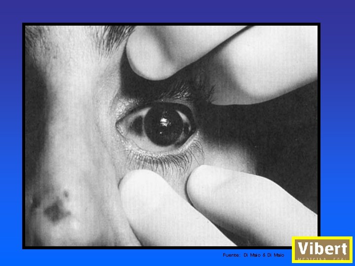 Fuente: Di Maio & Di Maio 