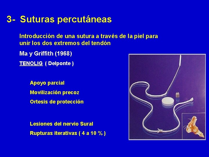 3 - Suturas percutáneas Introducción de una sutura a través de la piel para