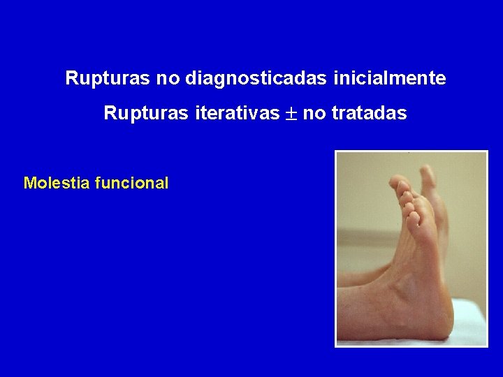 Rupturas no diagnosticadas inicialmente Rupturas iterativas no tratadas Molestia funcional 