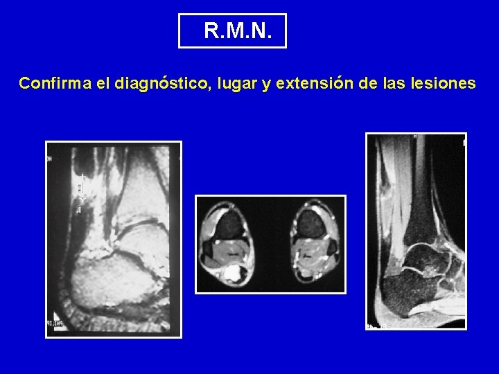  R. M. N. Confirma el diagnóstico, lugar y extensión de las lesiones 