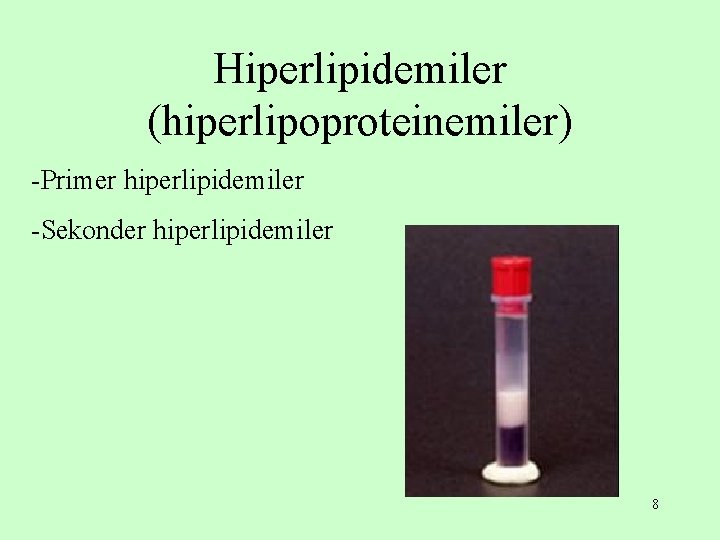 Hiperlipidemiler (hiperlipoproteinemiler) -Primer hiperlipidemiler -Sekonder hiperlipidemiler 8 