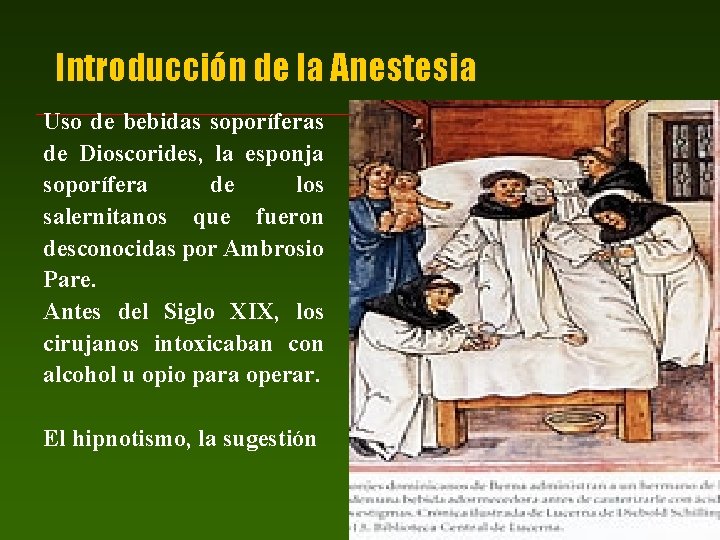 Introducción de la Anestesia Uso de bebidas soporíferas de Dioscorides, la esponja soporífera de Introducción de la Anestesia Uso de bebidas soporíferas de Dioscorides, la esponja soporífera de