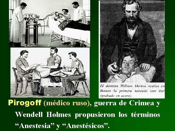 Pirogoff (médico ruso), guerra de Crimea y Wendell Holmes propusieron los términos “Anestesia” y Pirogoff (médico ruso), guerra de Crimea y Wendell Holmes propusieron los términos “Anestesia” y