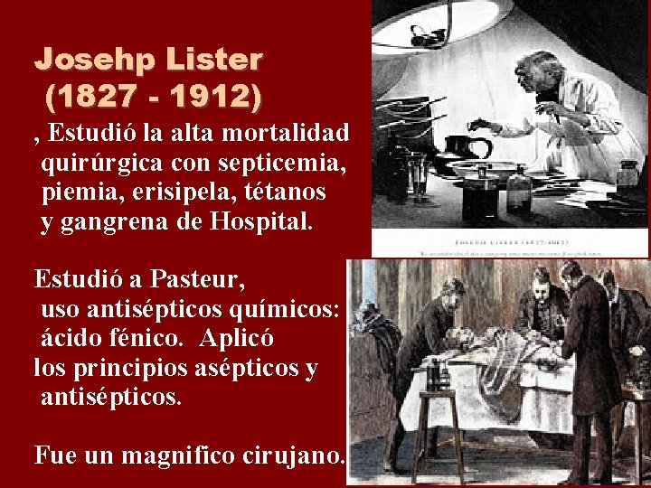 Josehp Lister (1827 - 1912) , Estudió la alta mortalidad quirúrgica con septicemia, piemia, Josehp Lister (1827 - 1912) , Estudió la alta mortalidad quirúrgica con septicemia, piemia,