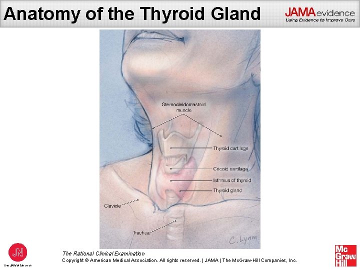 Does This Patient Have A Goiter The Rational