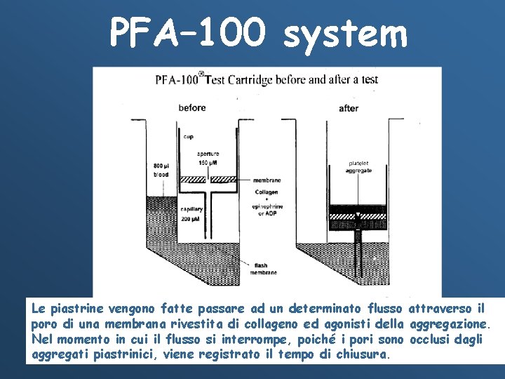 PFA– 100 system La cartuccia prima e dopo il test Le piastrine vengono fatte