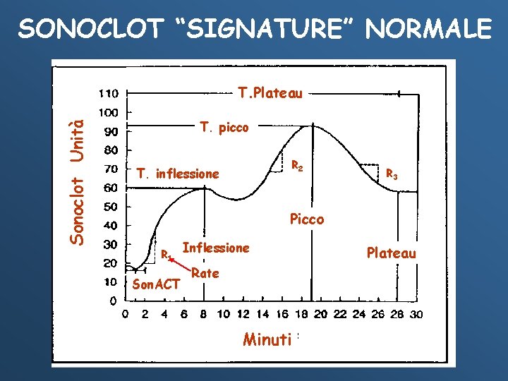 SONOCLOT “SIGNATURE” NORMALE Sonoclot Unità T. Plateau T. picco R 2 T. inflessione R