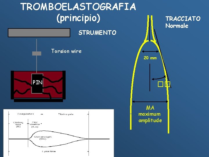 TROMBOELASTOGRAFIA (principio) TRACCIATO Normale STRUMENTO Torsion wire 20 mm PIN �� MA maximum amplitude