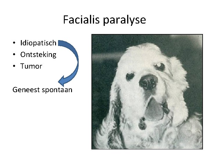 Facialis paralyse • Idiopatisch • Ontsteking • Tumor Geneest spontaan 