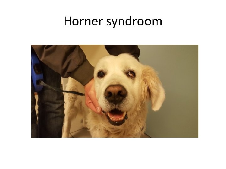 Horner syndroom 