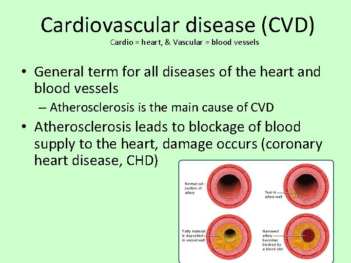 Cardiovascular disease (CVD) Cardio = heart, & Vascular = blood vessels • General term