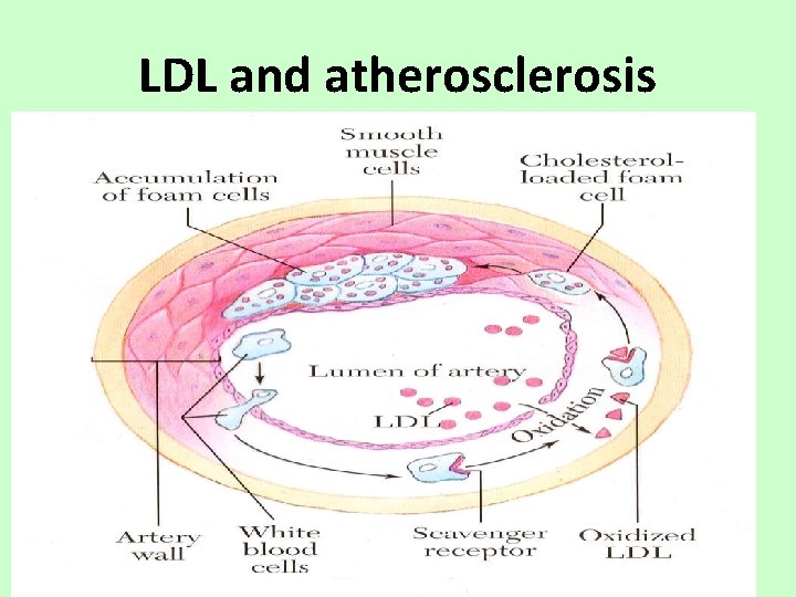 LDL and atherosclerosis 