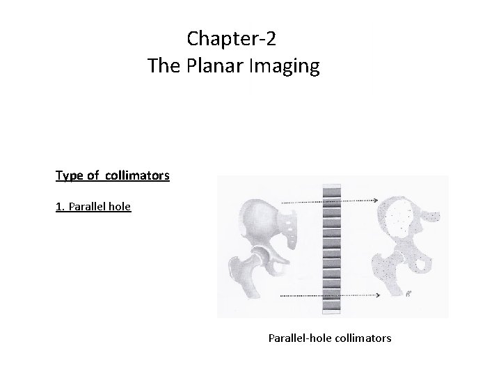 Chapter-2 The Planar Imaging Type of collimators 1. Parallel hole Parallel-hole collimators Chapter-2 The Planar Imaging Type of collimators 1. Parallel hole Parallel-hole collimators