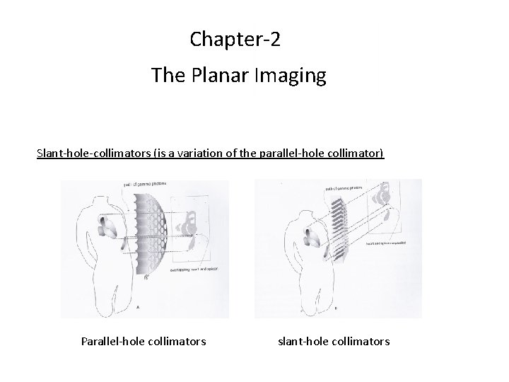 Chapter-2 The Planar Imaging Slant-hole-collimators (is a variation of the parallel-hole collimator) Parallel-hole collimators Chapter-2 The Planar Imaging Slant-hole-collimators (is a variation of the parallel-hole collimator) Parallel-hole collimators