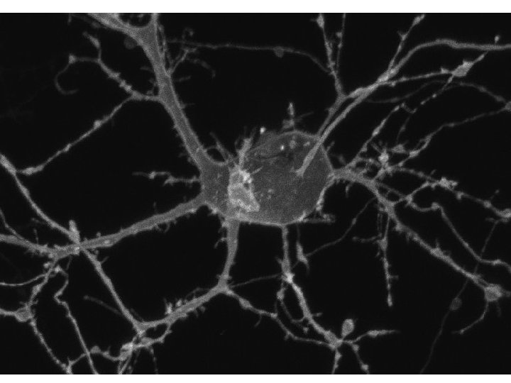 Anatomy of the axon 