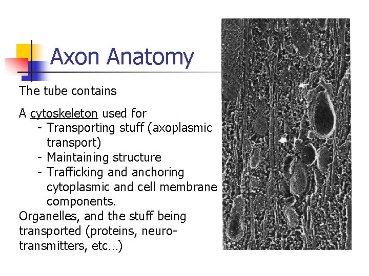 Axon Anatomy The tube contains A cytoskeleton used for - Transporting stuff (axoplasmic transport)