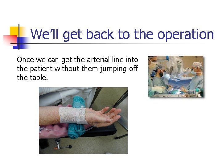We’ll get back to the operation Once we can get the arterial line into