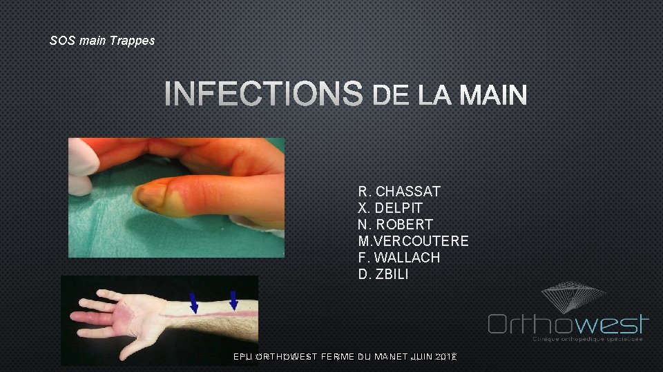 SOS main Trappes INFECTIONS DE LA MAIN R. CHASSAT X. DELPIT N. ROBERT M.