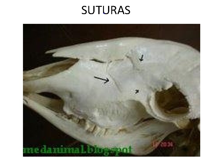 SUTURAS 