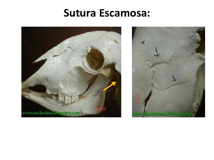 Sutura Escamosa: 