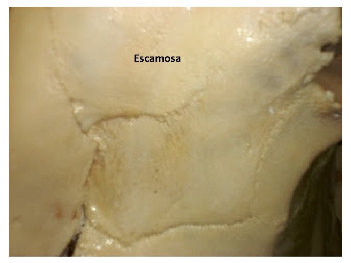 Escamosa 