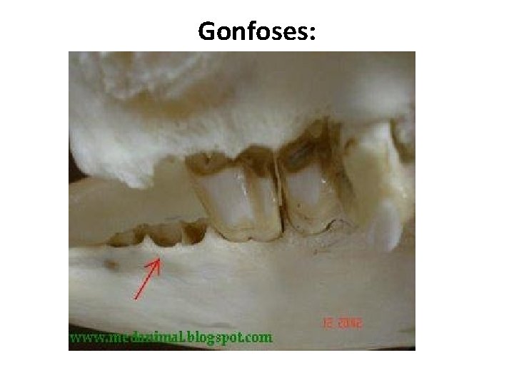 Gonfoses: 