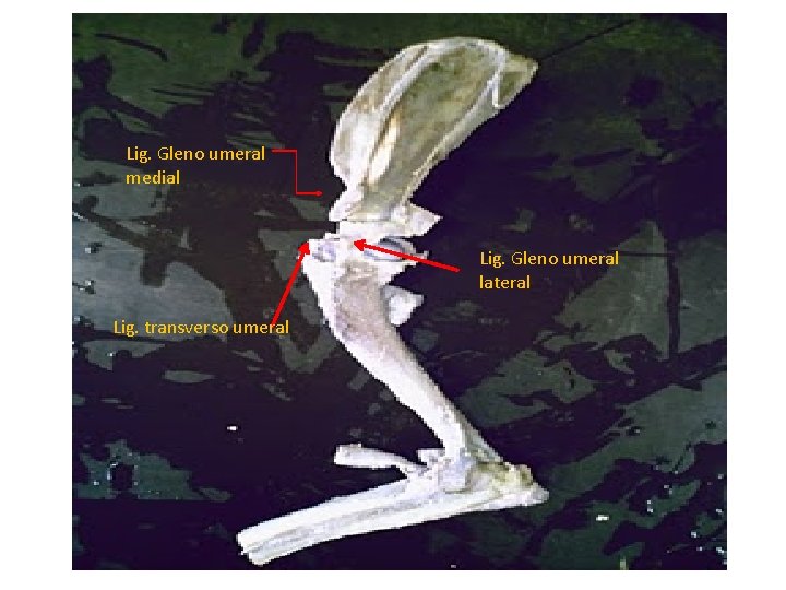 Lig. Gleno umeral medial Lig. Gleno umeral lateral Lig. transverso umeral 