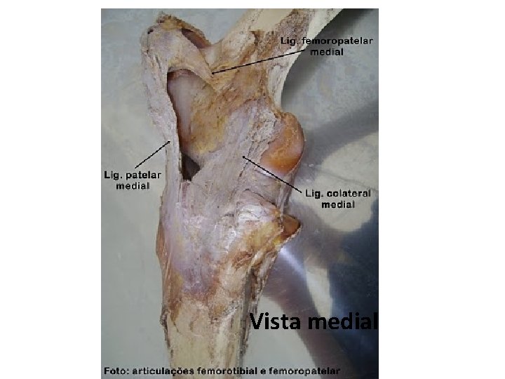 Vista medial 