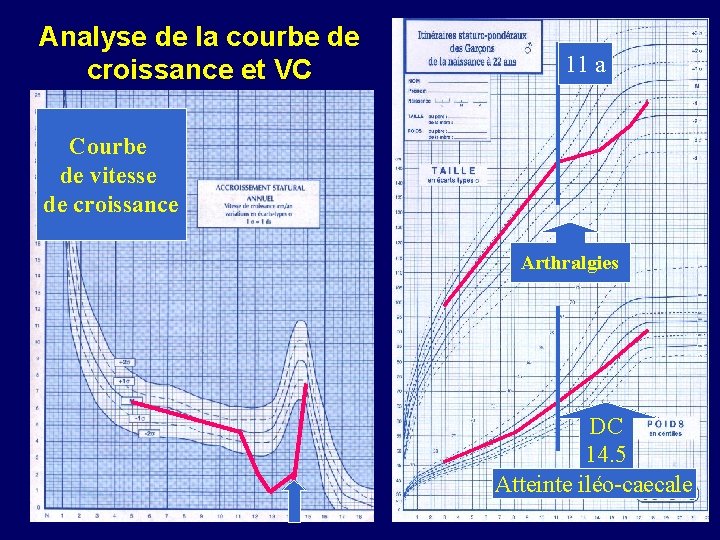 Analyse de la courbe de croissance et VC 11 a Courbe de vitesse de