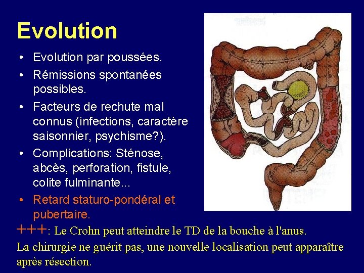 Evolution • Evolution par poussées. • Rémissions spontanées possibles. • Facteurs de rechute mal