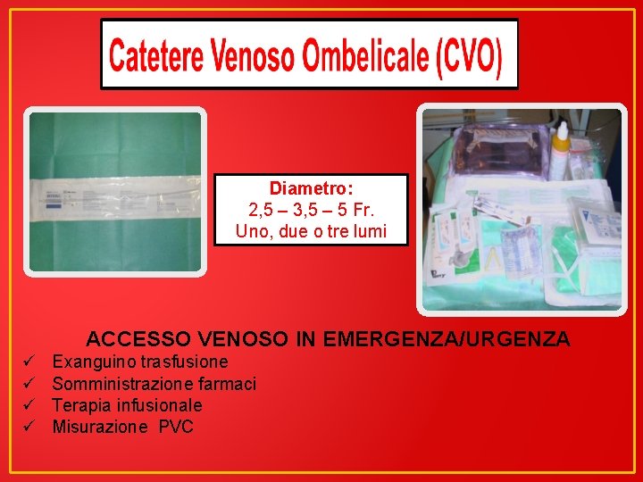 Diametro: 2, 5 – 3, 5 – 5 Fr. Uno, due o tre lumi