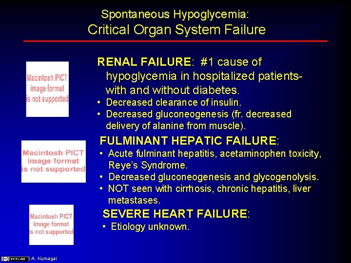 Spontaneous Hypoglycemia: Critical Organ System Failure RENAL FAILURE: #1 cause of hypoglycemia in hospitalized Spontaneous Hypoglycemia: Critical Organ System Failure RENAL FAILURE: #1 cause of hypoglycemia in hospitalized