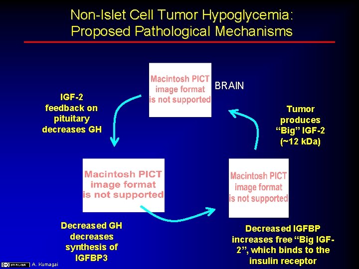Non-Islet Cell Tumor Hypoglycemia: Proposed Pathological Mechanisms BRAIN IGF-2 feedback on pituitary decreases GH
