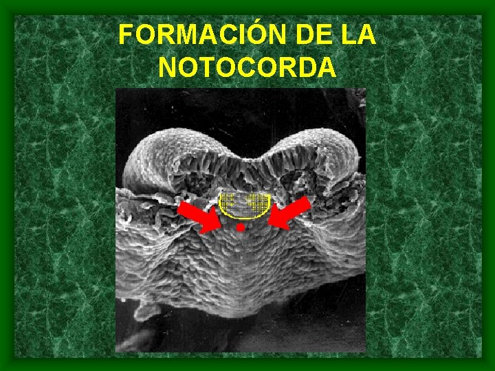 FORMACIÓN DE LA NOTOCORDA 