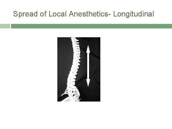 Spread of Local Anesthetics- Longitudinal 