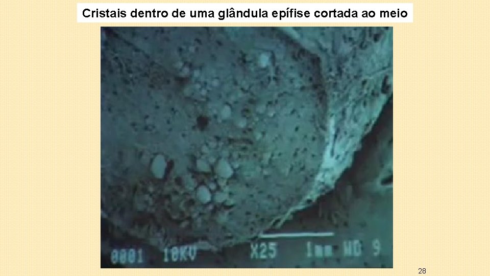 Cristais dentro de uma glândula epífise cortada ao meio 28 