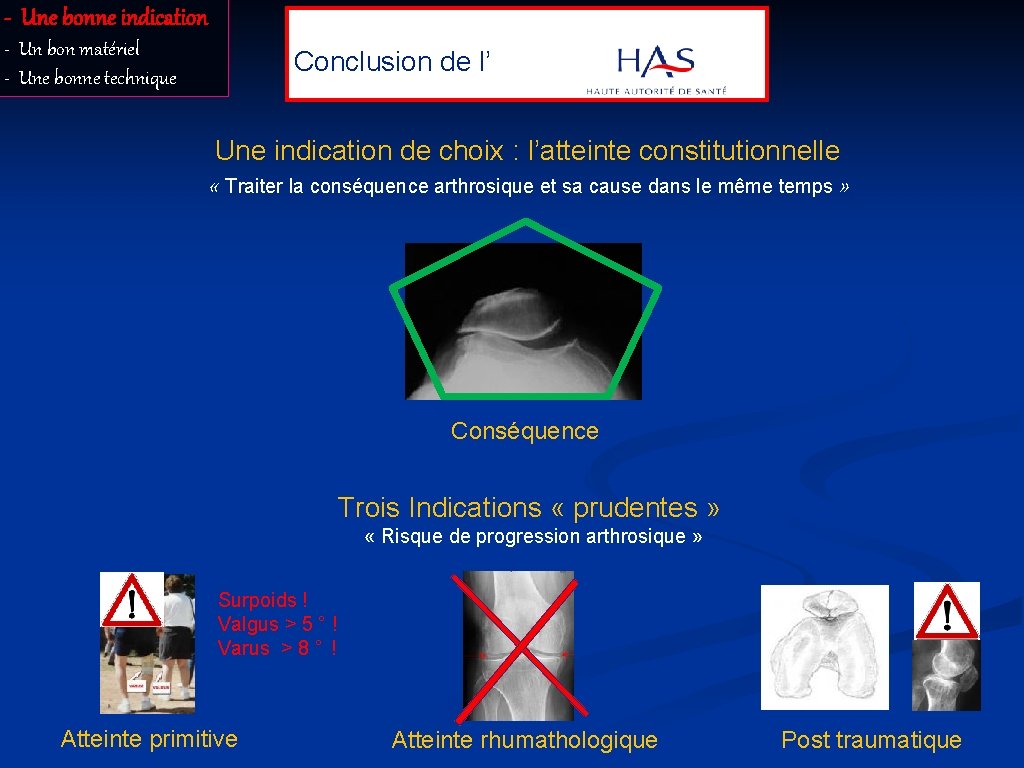 - Une bonne indication Conclusion de l’ - Un bon matériel - Une bonne