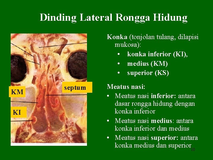 Dinding Lateral Rongga Hidung Konka (tonjolan tulang, dilapisi mukosa): • konka inferior (KI), •