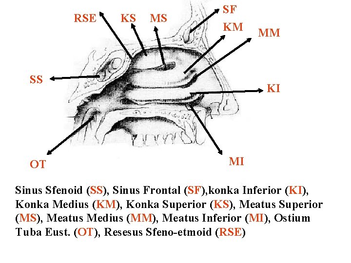 RSE KS MS SF KM SS OT MM KI MI Sinus Sfenoid (SS), Sinus