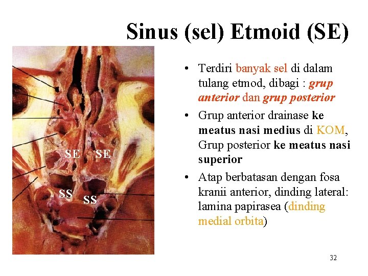 Sinus (sel) Etmoid (SE) SE SE SS SS • Terdiri banyak sel di dalam
