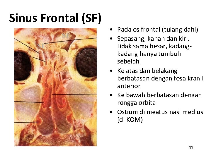Sinus Frontal (SF) SF SF • Pada os frontal (tulang dahi) • Sepasang, kanan