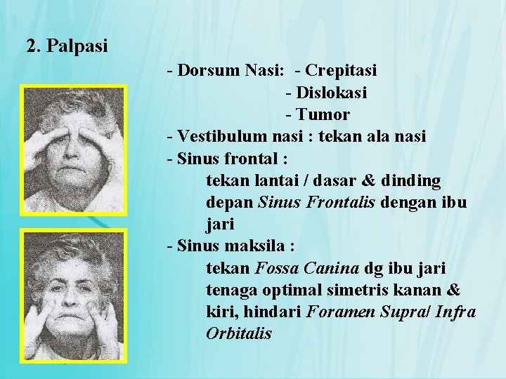 2. Palpasi - Dorsum Nasi: - Crepitasi - Dislokasi - Tumor - Vestibulum nasi