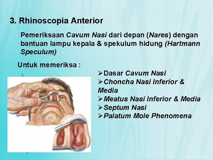 3. Rhinoscopia Anterior Pemeriksaan Cavum Nasi dari depan (Nares) dengan bantuan lampu kepala &